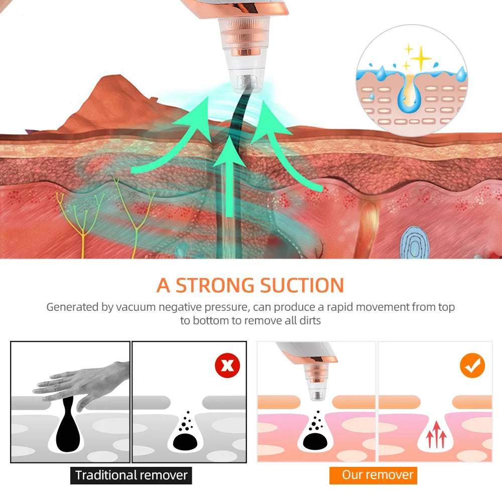 Nose Blackhead Remover Face Cleansing Beauty Machine